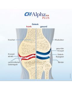 CH ALPHA Gelenk Gel