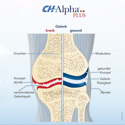 CH-Alpha Gelenk-Gel